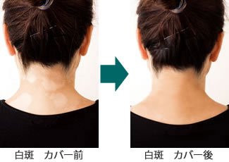 白斑　カバー前&rarr;カバー後