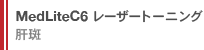MedLite C6 レーザートーニング 肝斑治療